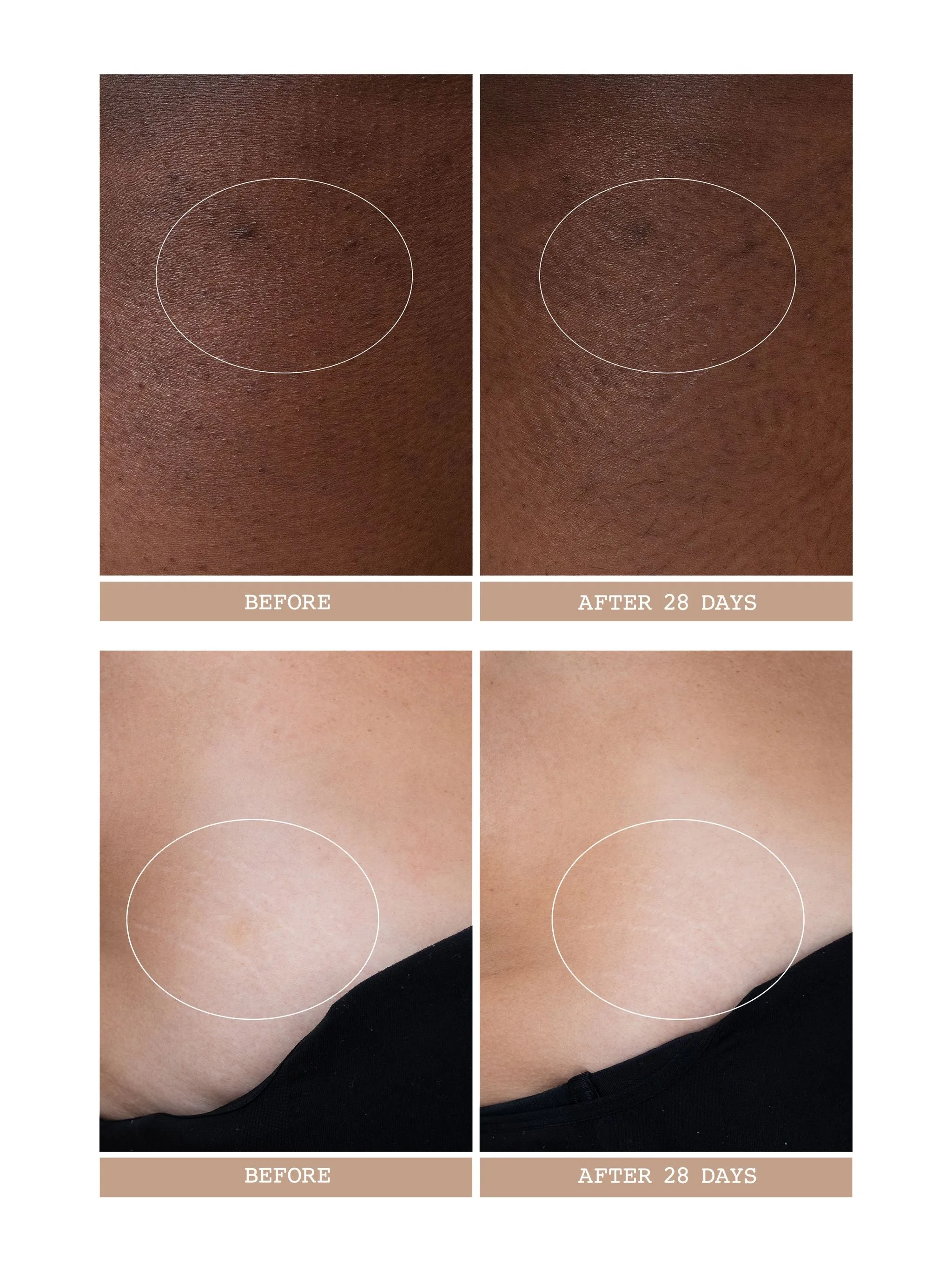 Body Reform Treatment Serum with Granactive Retinoid