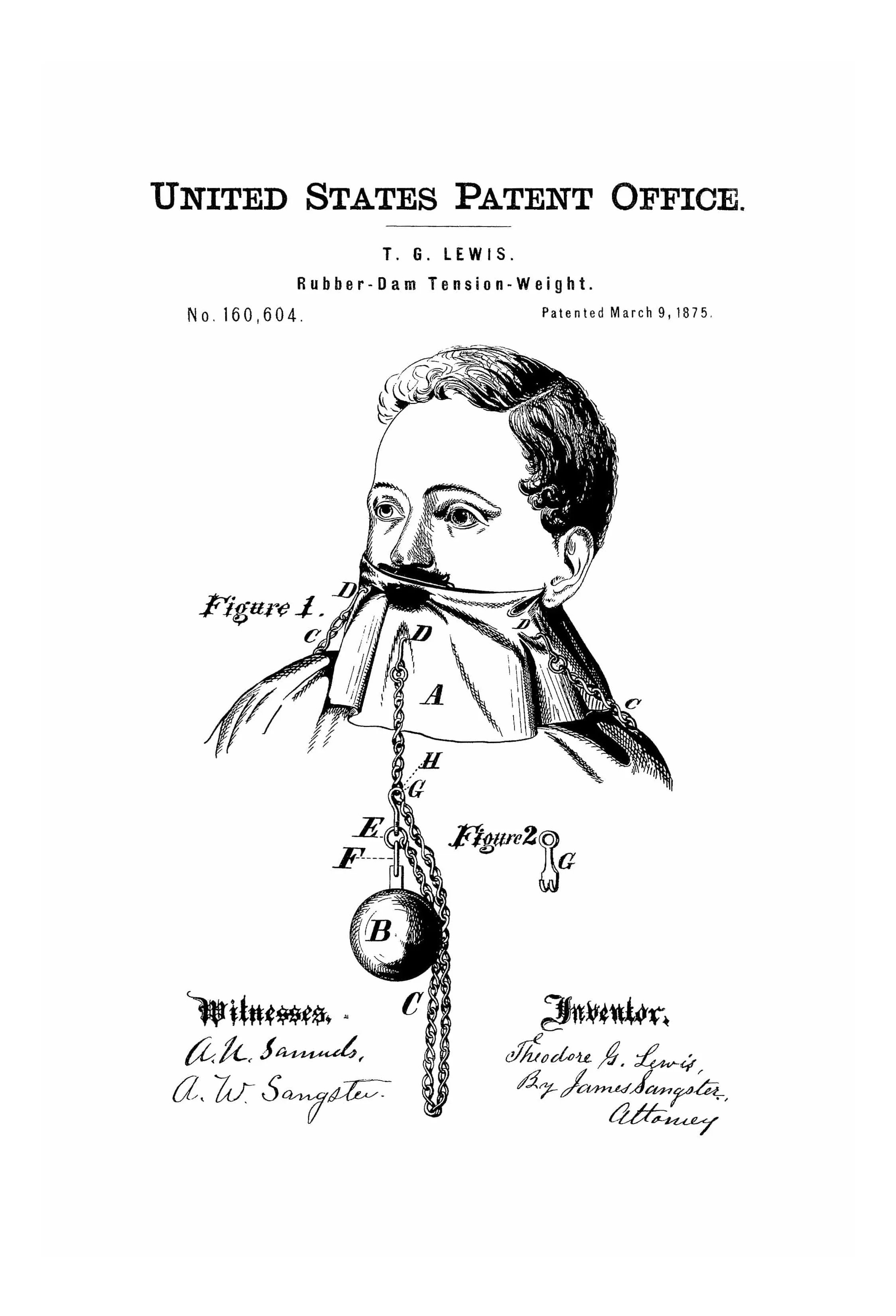 Dentist Rubber Dam Patent 1875 - Dental Dam, Wall Decor, Dental Office Decor, Medical Art, Dental Art, Dentist Decor, Dental Tools Patent