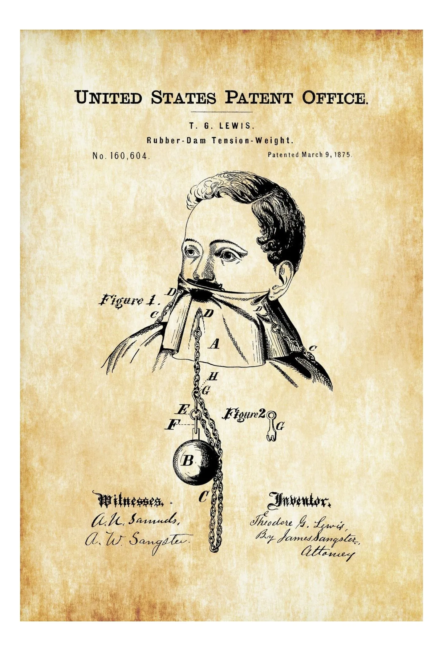 Dentist Rubber Dam Patent 1875 - Dental Dam, Wall Decor, Dental Office Decor, Medical Art, Dental Art, Dentist Decor, Dental Tools Patent