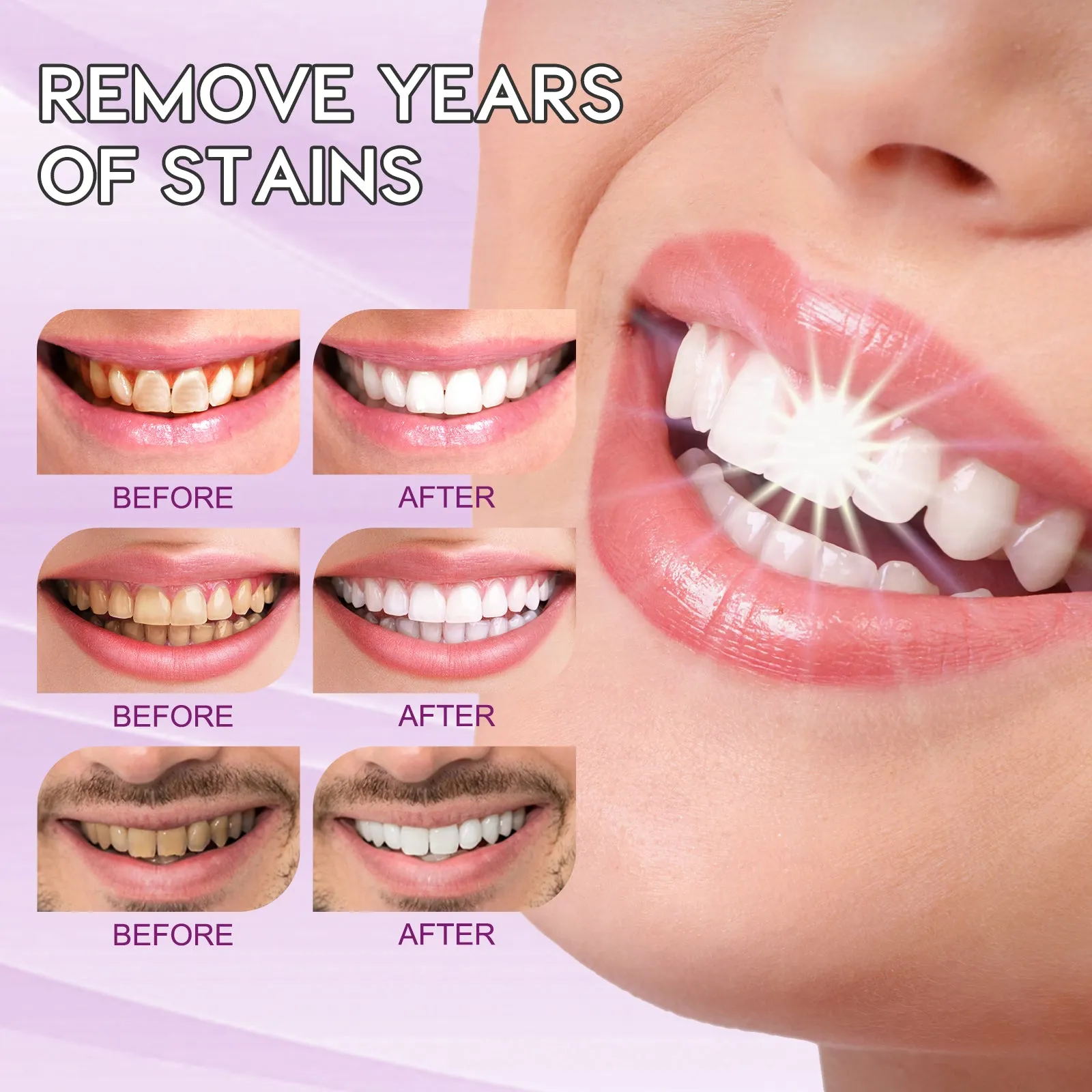 ELAIMEI Repair Teeth Whitening Toothpaste