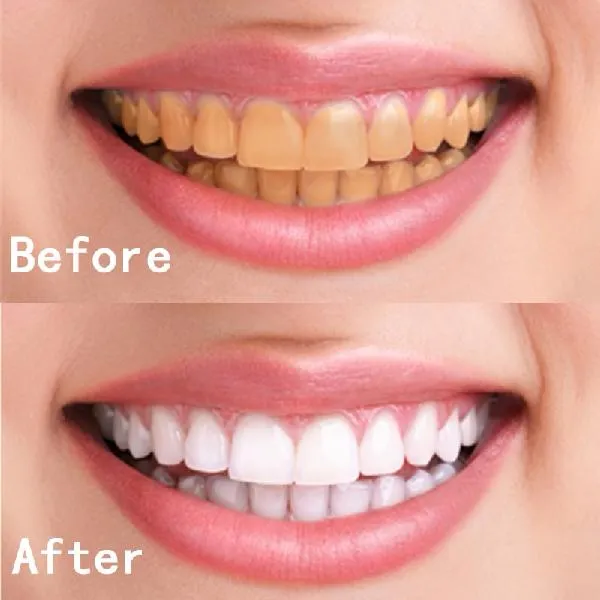 Stain Removal  &  Whitening Toothpaste